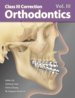 Orthodontics Vol. III: CIII Correction by John Jin-Jong Lin, Johnny Liaw, Chris Chang & W. Eugene Roberts