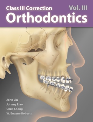 Orthodontics Vol. III: CIII Correction