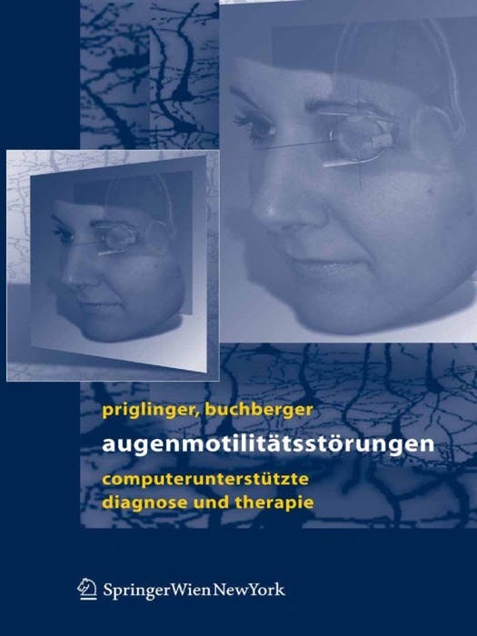 Augenmotilitätsstörungen