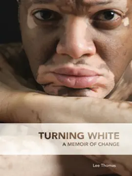 Read: Turning White Book