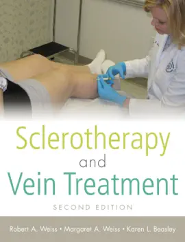 Sclerotherapy and Vein Treatment, Second Edition