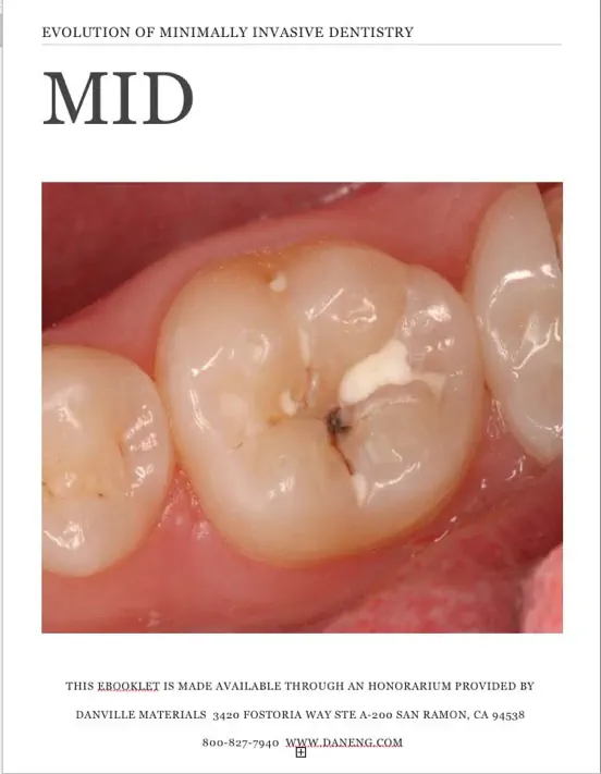 Minimally Invasive Dentistry-MID