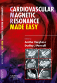 Cardiovascular Magnetic Resonance Made Easy - Anitha Varghese MBBS, BSc, MRCP & Dudley J. Pennell MD, FRCP, FACC