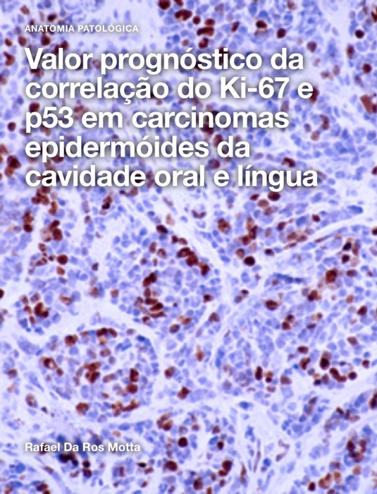 Valor prognóstico da correlação do Ki-67 e p53 em carcinomas epidermóides da cavidade oral e língua