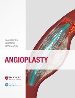 Angioplasty by Harvard Health Publications & Orca Health