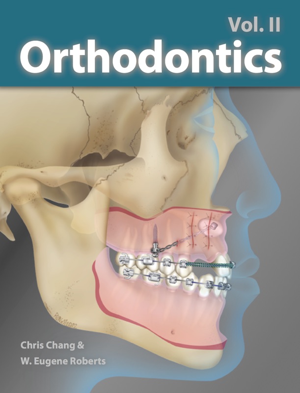 Orthodontics Vol. II