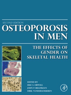 Osteoporosis in Men by Eric S. Orwoll, John P. Bilezikian & Dirk Vanderschueren