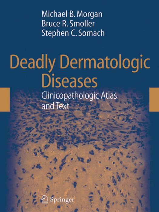 Deadly Dermatologic Diseases