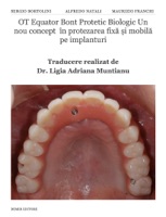OT Equator Bont Protetic Biologic Un nou concept în protezarea fixă și mobilă pe implanturi