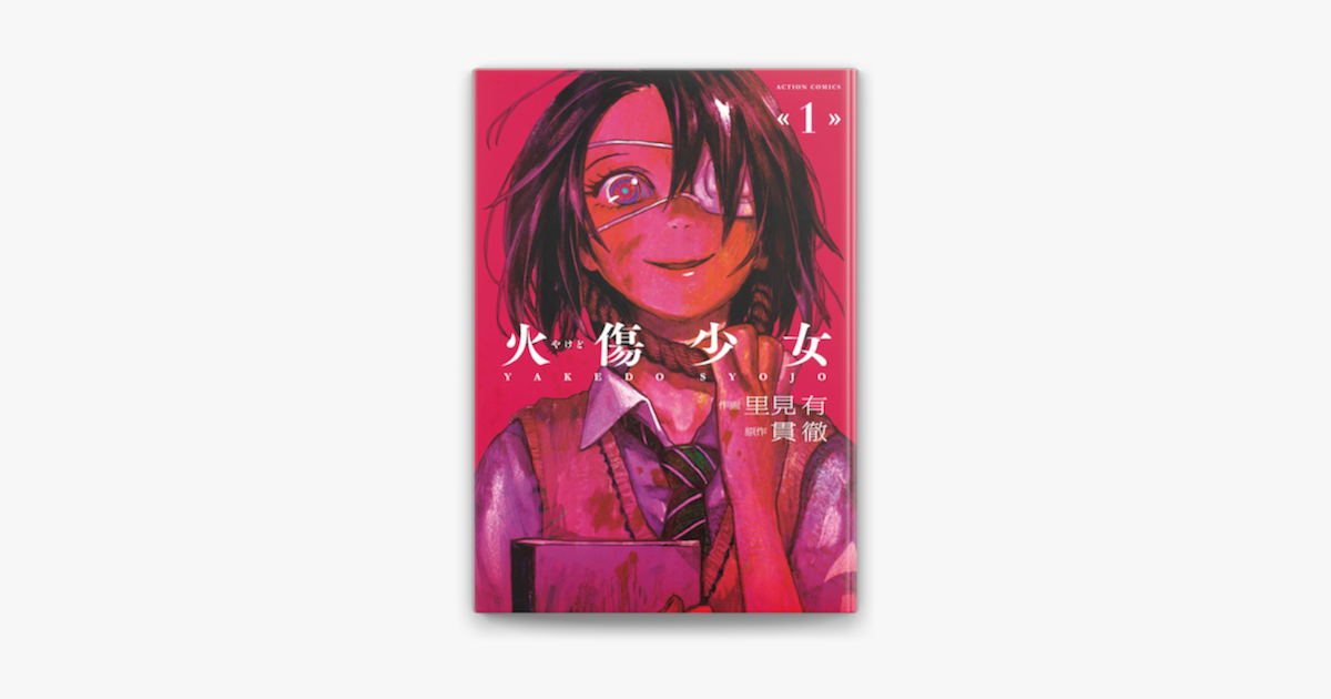 Apple Booksで火傷少女 1を読む Apple Booksで火傷少女 1を読む