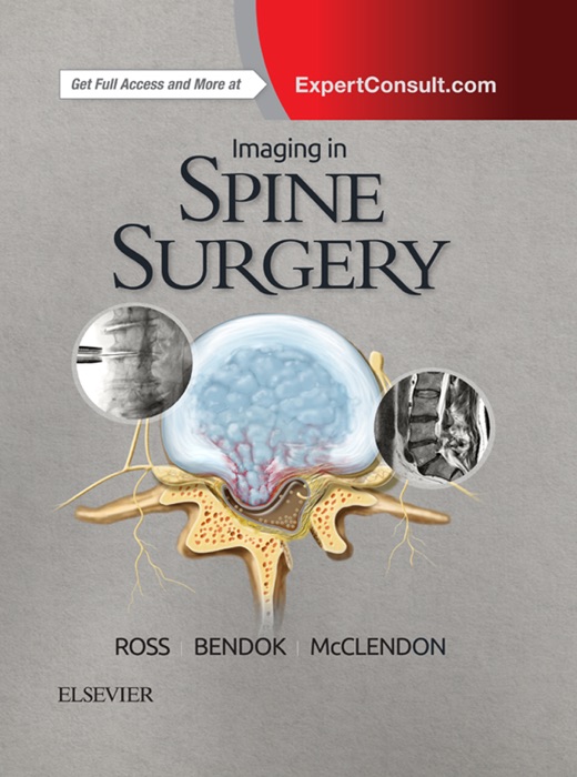 Imaging in Spine Surgery E-Book