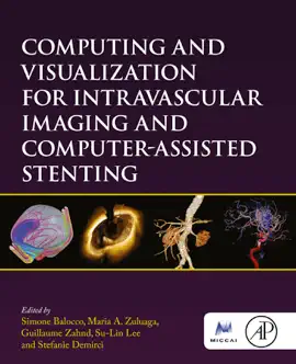 Read: Computing Book and Visualization for Intravascular Imaging and Computer-Assisted Stenting