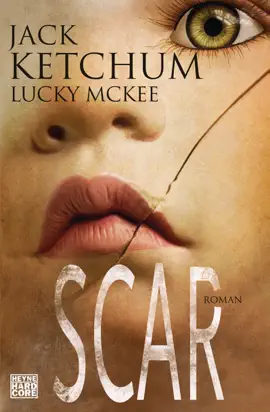 Read: SCAR