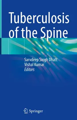 Read: Book Tuberculosis of the Spine