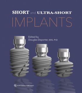 Short and Ultra-Short Implants by Douglas Deporter