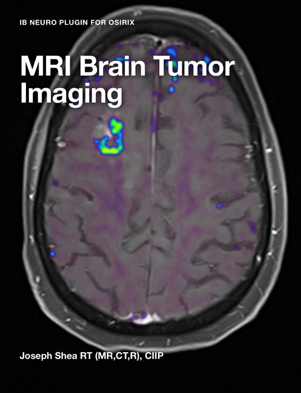 MRI Brain Tumor Imaging