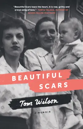 Read: Book Beautiful Scars
