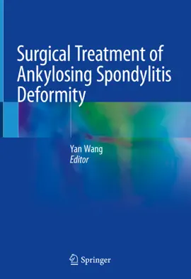 Read: Surgical Treatment of Book Ankylosing Spondylitis Deformity