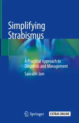 Read: Simplifying Strabismus Book