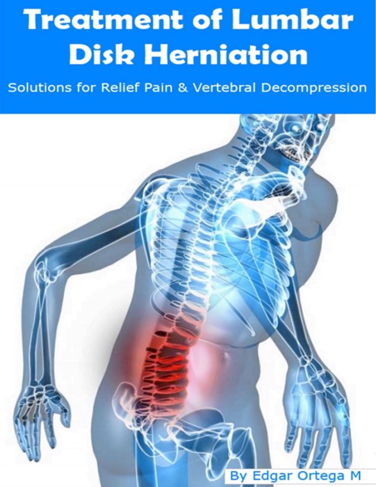 Treatment of Lumbar Disk Herniation