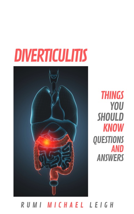 Diverticulitis