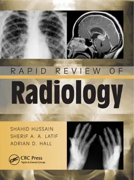 Read: Rapid Review Book of Radiology