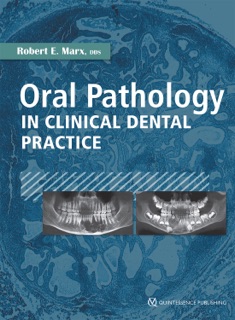 Oral Pathology in Clinical Dental Practice by Robert E. Marx