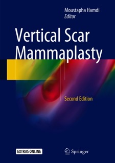 Vertical Scar Mammaplasty by Moustapha Hamdi