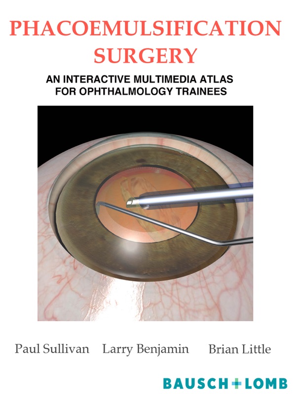 Phacoemulsification Surgery