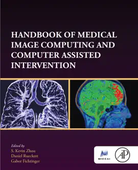 Read: Handbook of Book Medical Image Computing and Computer Assisted Intervention