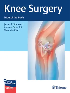 Read: Knee Book Surgery