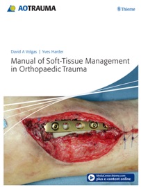 Manual of Soft-Tissue Management in Orthopaedic Trauma - David A. Volgas & Yves Harder