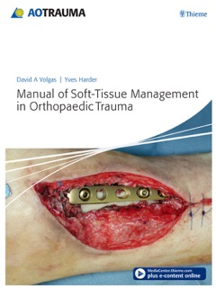 Manual of Soft-Tissue Management in Orthopaedic Trauma by David A. Volgas & Yves Harder
