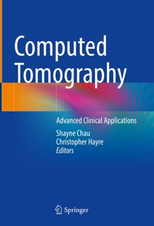 Computed Tomography by Shayne Chau & Christopher Hayre
