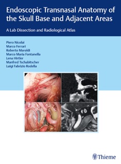 Endoscopic Transnasal Anatomy of the Skull Base and Adjacent Areas by Piero Nicolai, Marco Ferrari, Roberto Maroldi, Marco Maria Fontanella, Lena Hirtler, Manfred Tschabitscher & Luigi Fabrizio Rodella