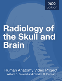 Radiology of the Skull and Brain