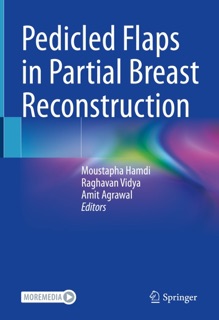 Pedicled Flaps in Partial Breast Reconstruction by Moustapha Hamdi, Raghavan Vidya & Amit Agrawal