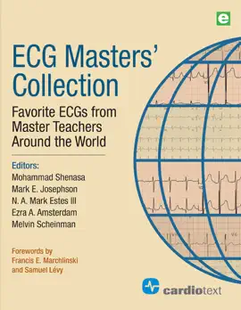 Read: ECG Masters Collection Book