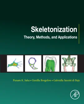 Read: Skeletonization