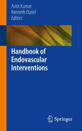 Read: Handbook of Endovascular Book Interventions