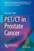 PET/CT in Prostate Cancer - Gary Cook