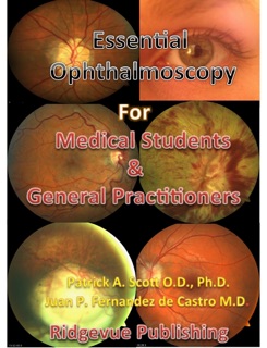 Essential Ophthalmoscopy by Patrick A. Scott