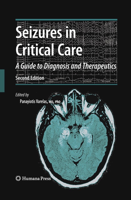 Seizures in Critical Care