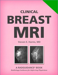 Clinical Breast MRI by Steven E. Harms, MD