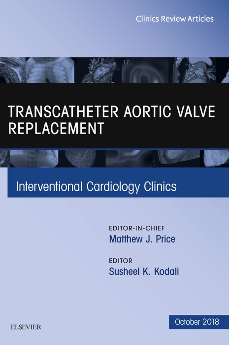 Transcatheter Aortic Valve Replacement, An Issue of Interventional Cardiology Clinics E-Book