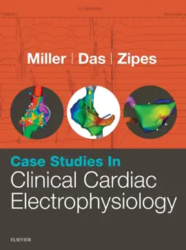 Read: Case Book Studies in Clinical Cardiac Electrophysiology E-Book