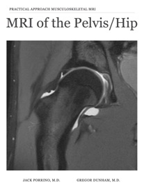MRI of the Pelvis/Hip