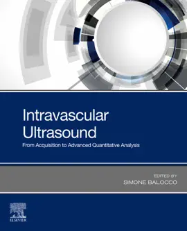 Read: Book Intravascular Ultrasound