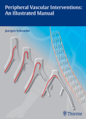 Peripheral Vascular Interventions: An Illustrated Manual - Juergen Schroeder