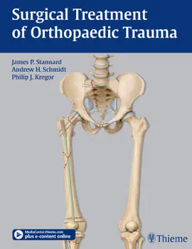 Read: Surgical Book Treatment of Orthopaedic Trauma